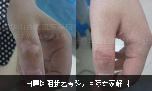 ��������տ�·������ר�ҽ���