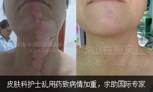 Ƥ���ƻ�ʿ����ҩ�²�����أ���������ר��