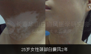 25��Ů�Ծ�������2��