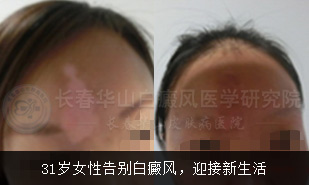 31��Ů�Ը����磬ӭ��������