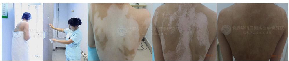 311խ��UVB����������ʵ����