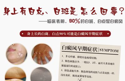 �����а׵㡢�װ�����ô���£�